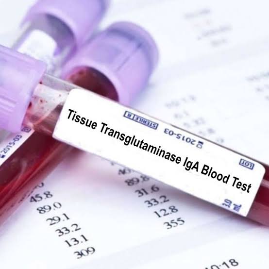 Tissue transglutaminase lgA (tTg- A)