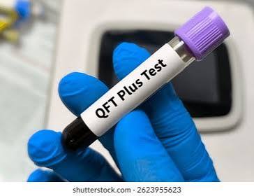 QuantiFERON TB Gold Plus / TB- IGRA (QFT- Plus)
