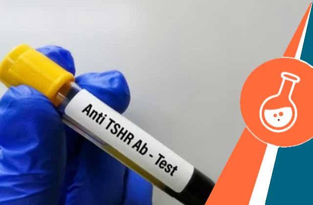 TSH Receptor Antibody (TRAB/TSHR)