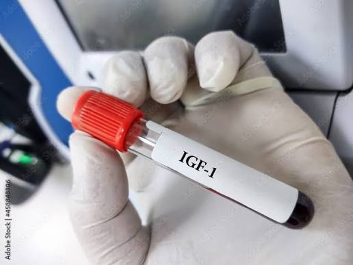 Insulin Like Growth Factor (IGF - 1)