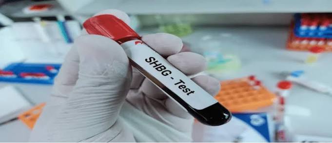 SHBG (Sex Hormone Biding Globulin)