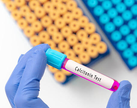 Calcitonin