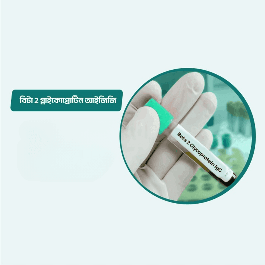 Anti- B2 Glycoprotectin l Antibody- lgG