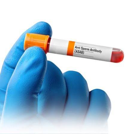 Anti- Sperm Antibody (ASAB)