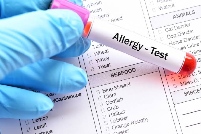 Allergy Panel