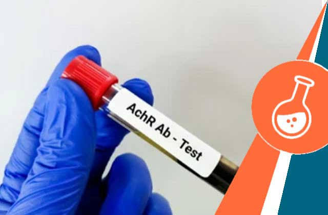 Acetylcholine Receptor Antibody (AchR)