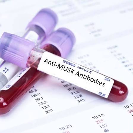 Anti- Musk antibody (Muscle- Specific Kinase antibody)