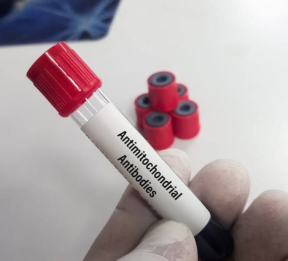 Anti- Mitochondrial Ab (AMA)