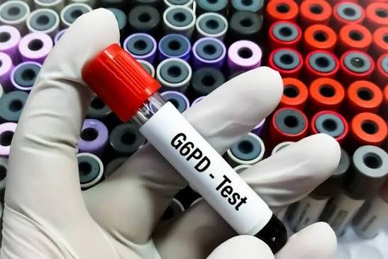Glucose- 6- Phosphate Dehydrogenase (G6PD)