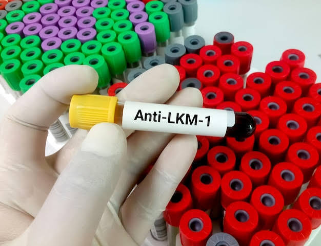 Anti- LKM- Antibody