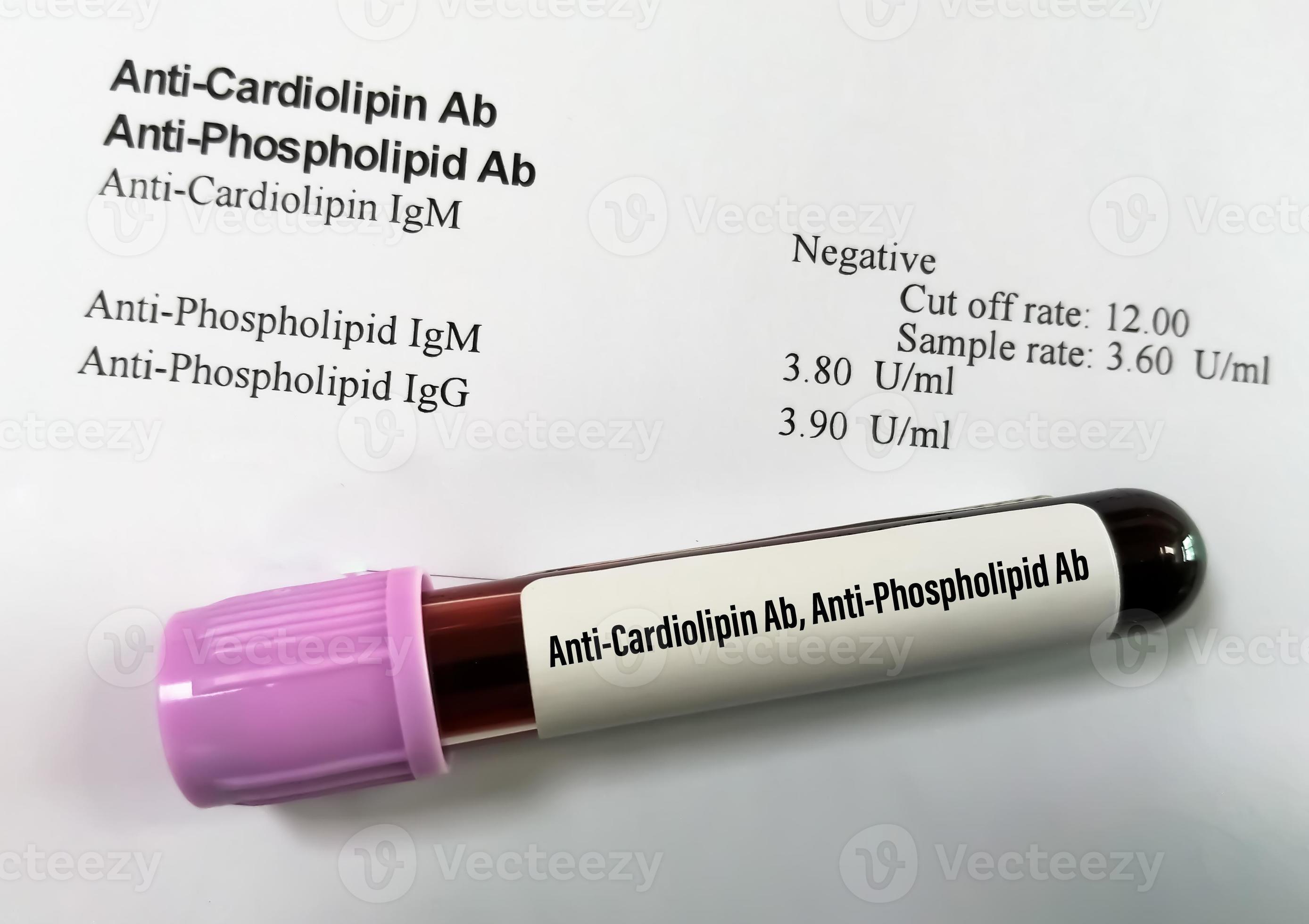 Anti Phosholipid Syndrome (Aps) Panel: Lupus Anticoagulant/ Anti Cardiolipin Ab/ Beta 2 Glycoprotein 1 Ab