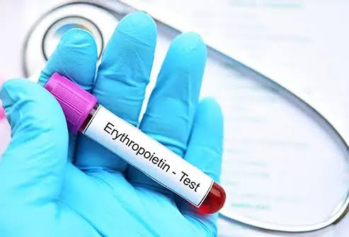 Erythropoietne (EPO)