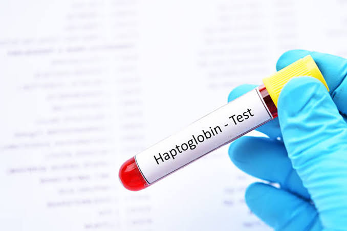 Serum Haptoglobin