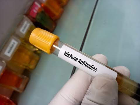Histone