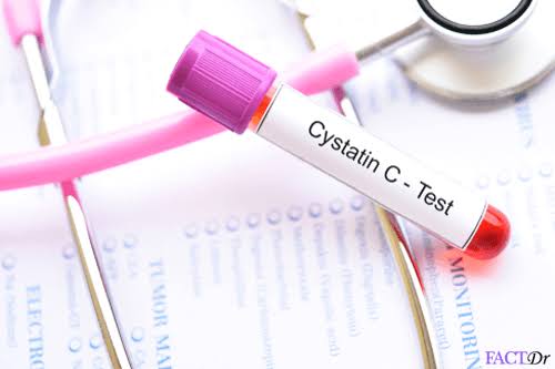 Cystatin C