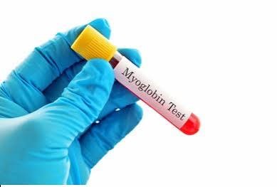 Myoglobin