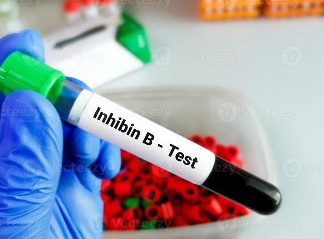 Inhibin A