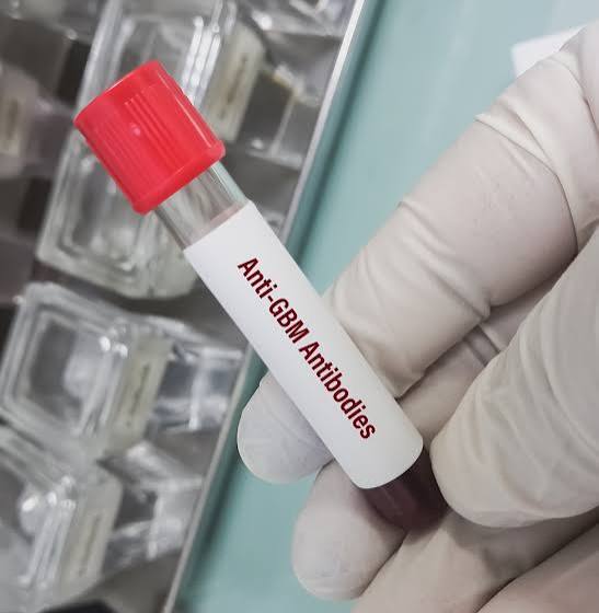 GBM Antibody