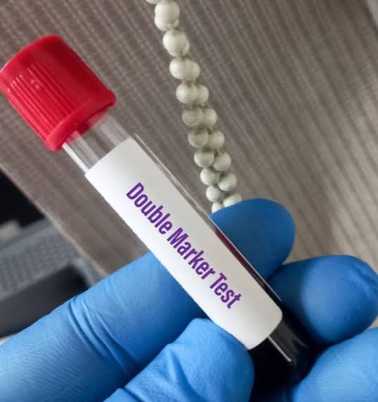 Maternal Serum Screen (Dual Marker Test)