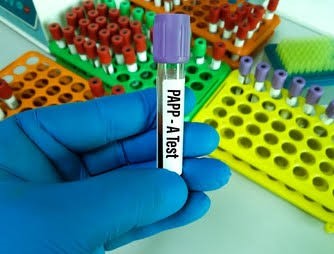 PAPP-A (Pregnancy- Associated Plasma Protein A)