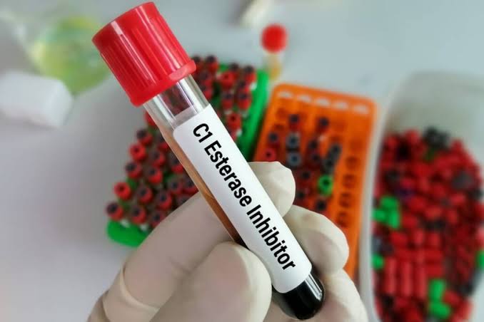 C1 Esterase Inhibitor (C1INH)