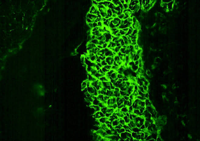 Endomysial Antibody ( EMA) lgA