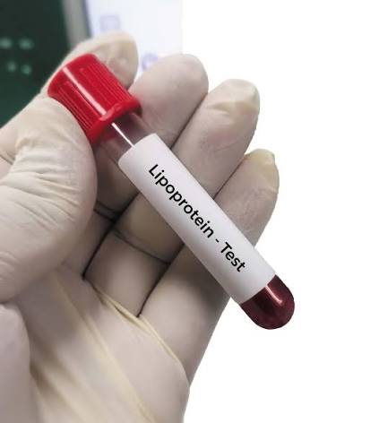 Lipoprotein (a)/Lp (a)