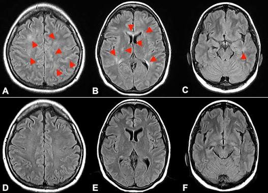 Anti-MOG (Myelin Oligodendrocyte Glycoprotein)Anibody