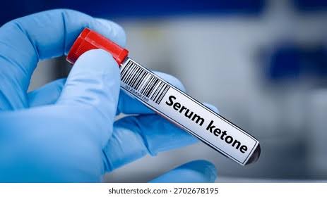 Serum Ketone Bodies