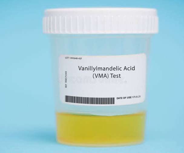 Vanillylmandelic Acid (VMA)