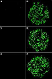 Anti- Phospolipase A2  Receptor Antibody (Anti- PLA2R Ab)