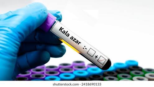 Kala- azar (Visceral Leishmaniasis)rK39 Antibody