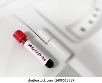 Plasma Free Metanephrines