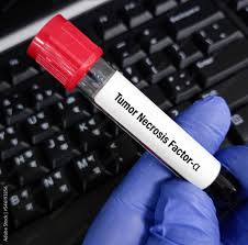 Tumor Necrosis Factor Alpha (TNF-a)
