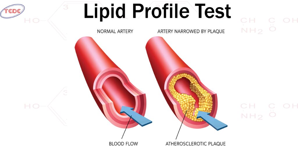 Lipid profile